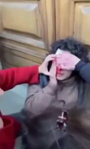 La polizia manganella a Firenze, Una ragazza ferita dai poliziotti a Firenze